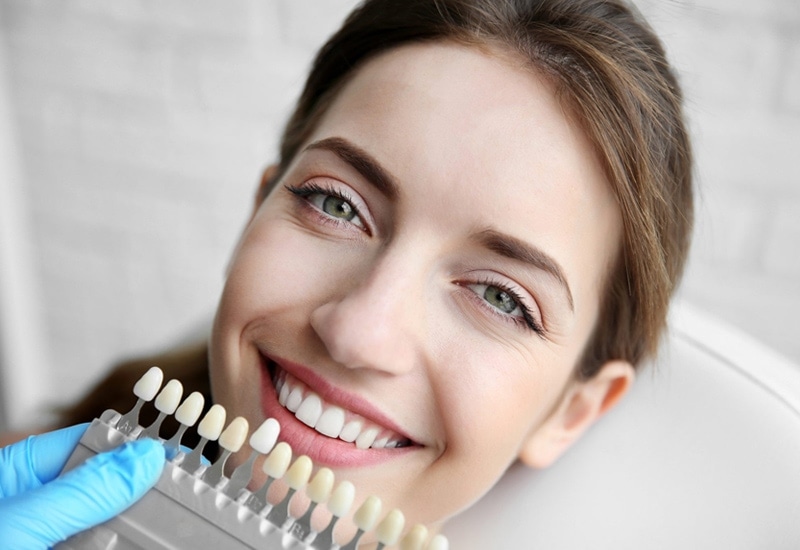 dental bonding in South Tampa