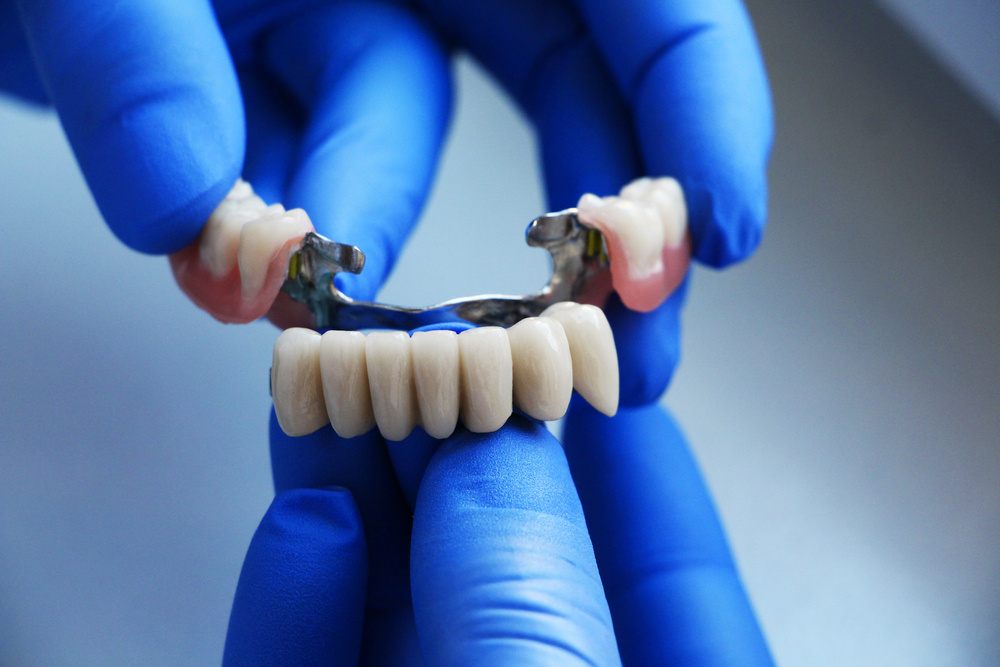 do you need a dental bridge explore the pros & cons
