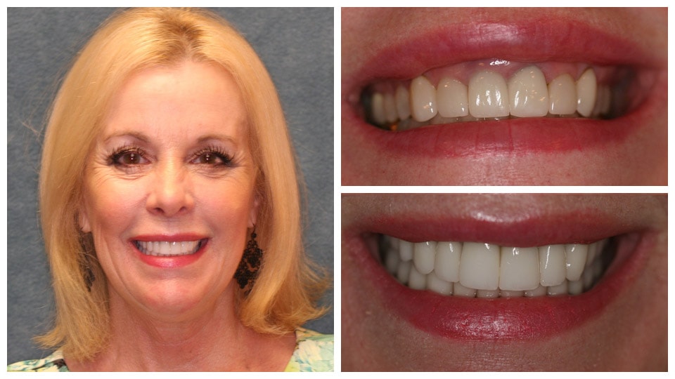 cosmetic dentistry tampa
