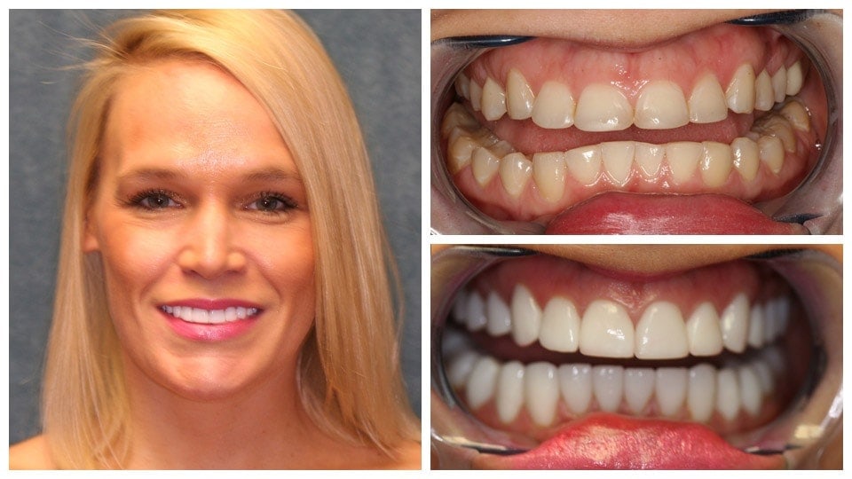 dental office treatment reusult