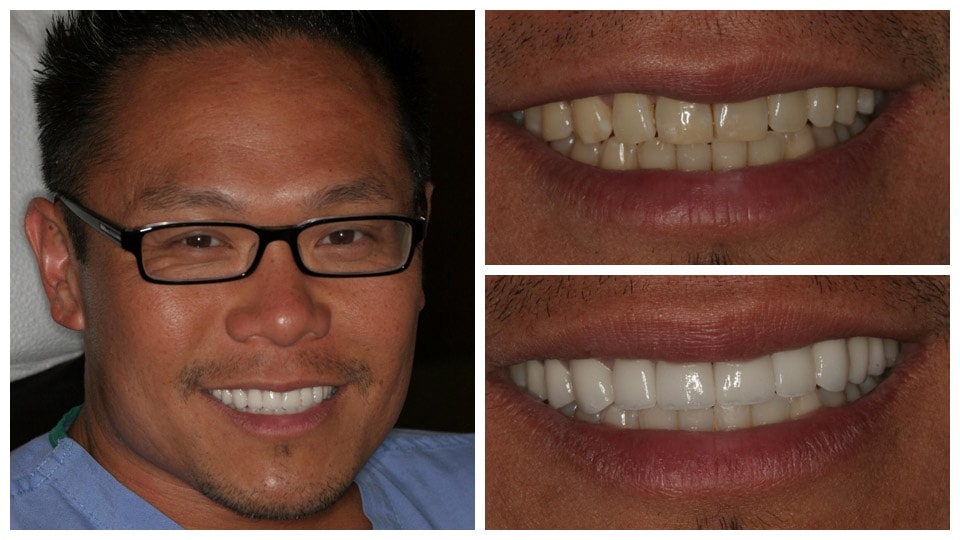 dental treatment at charles martin office