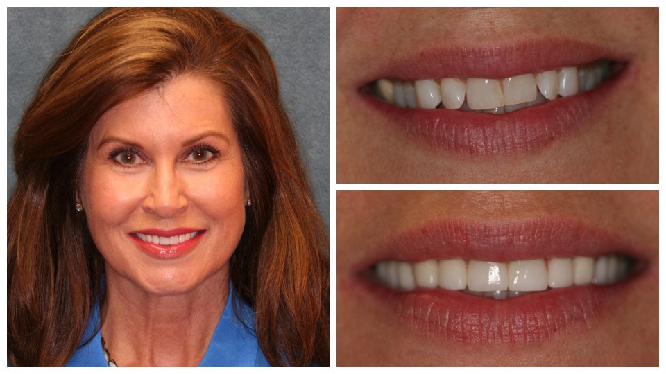 dental treatment result tampa