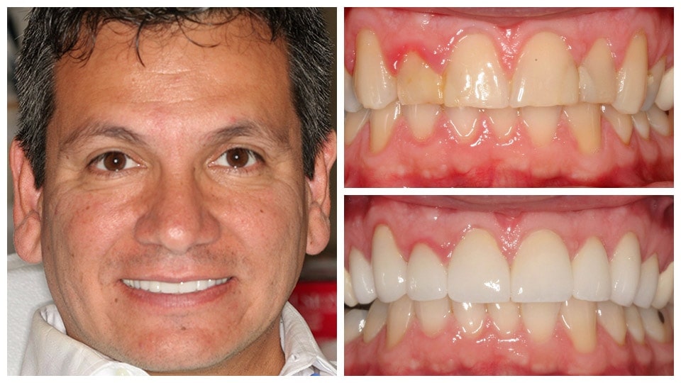 dental treatment result