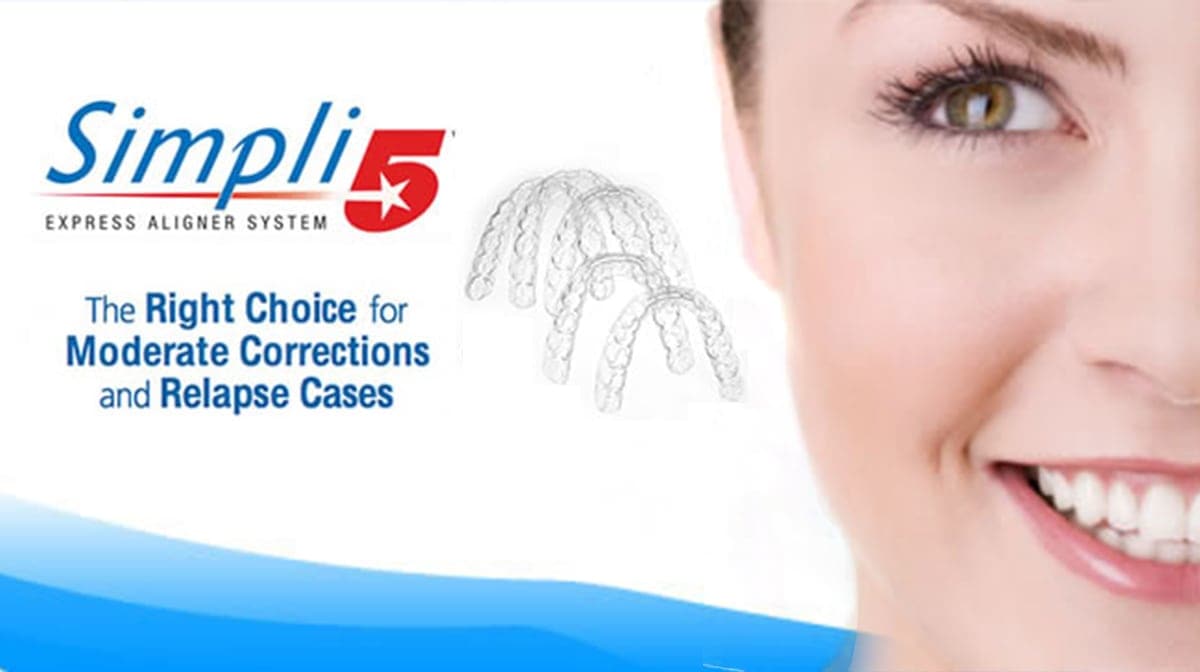 express aligner system